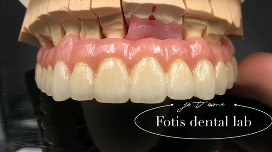Pembaharuan yang dapat diandalkan PFM Dental Crown Porselen Digabungkan Dengan Metal Crown Disesuaikan