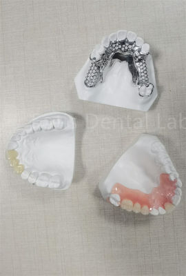 Dental Fleksibel yang Bisa Dihapus dan Mudah Dibersihkan