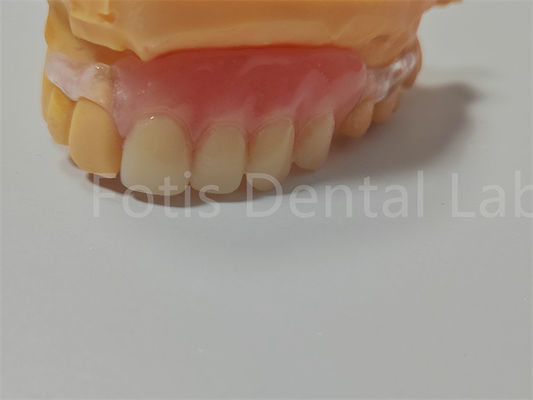 Sertifikasi FDA/ISO TCS Valplast Gigi Fleksibel Mudah Dibersihkan Sesuaikan