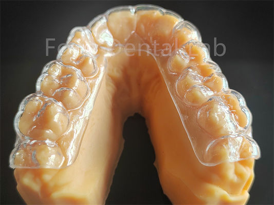 Custom Fit Hard Dental Guard Hard Mouth Guard Untuk Menggiling Gigi