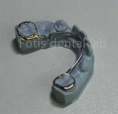 Cina Dental Lab Orthodontic Retainer Untuk Ekspansi Gigi