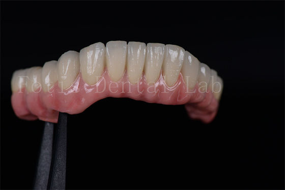 Beli Tingkat Sukses Tinggi Semua Pada Empat Semua Pada Enam Zirconia Titanium Implan Gigi Disesuaikan online manufacture