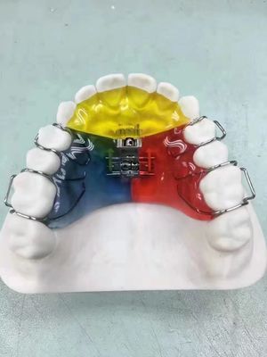 Nance / Hyrax / Rapid Palatal Expander Night Guard Space Keeper OEM Aman Untuk Digunakan