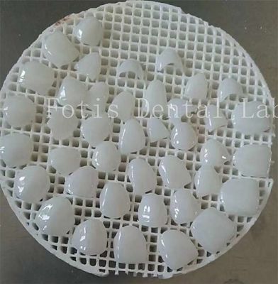 Tingkatkan permainan polishing Anda dengan tekstur permukaan halus kosmetik menutupi gigi