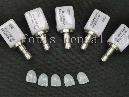 Furnir Gigi Tiruan Translucence Tinggi Ideal untuk Kedokteran Gigi Kosmetik yang Cantik