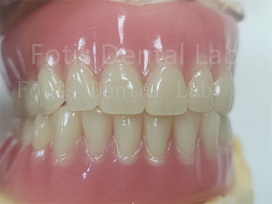 Comfort Custom Fit Full Acrylic Denture Untuk Prothesis Gigi yang Tepat