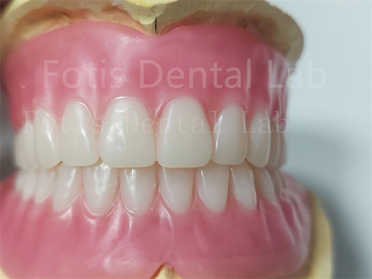 Warna alami yang tahan lama Full Acrylic Denture tanpa bau
