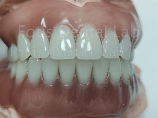 Dental akrilik lengkap dengan gigi Ivoclar