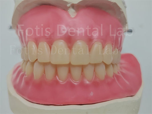 Harga terjangkau Custom Full Acrylic Denture Dengan Gigi Ivoclar Mudah Digunakan