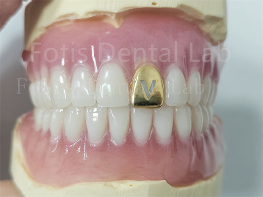 Nyaman Precision Fit Full Acrylic Gigi palsu dengan gigi alami