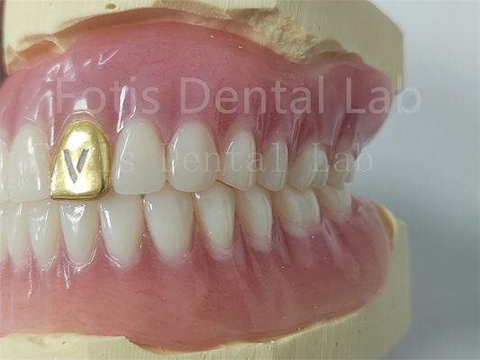 Dental Akrilik Full Denture yang dapat disesuaikan