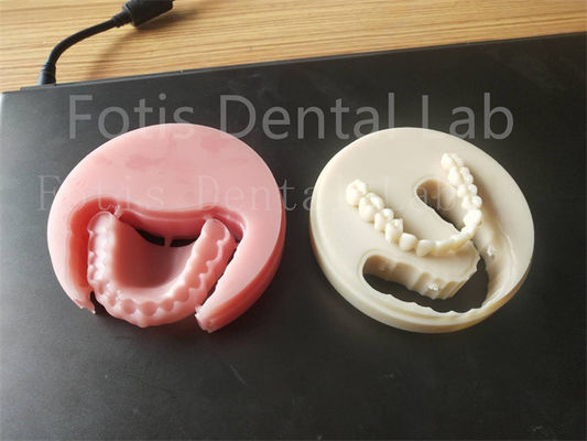 Comfort Fit Full Acrylic Prosthesis Gigi Untuk Teknisi Profesional Mudah Di Bersihkan