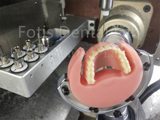 Ivoclar Warna Alami Full Acrylic Denture Kenyamanan Pas Prothesis Dengan Estetika