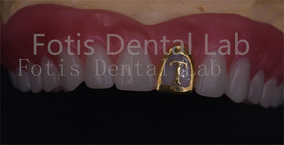 OEM Natural Full Acrylic Denture Ivoclar Teeth Stain Resistance