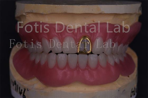 Teknisi Profesional Akrilik Gigi Lengkap Gigi Palsu Prosthetics Precision Fit