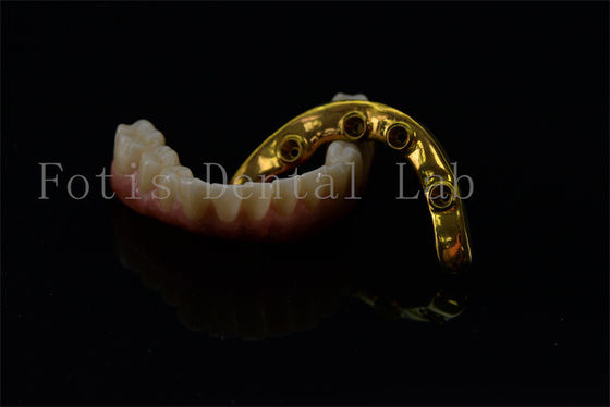 Titanium Zirconia All On 4 All On 6 Implanti Full Smile Implanti Jaminan seumur hidup