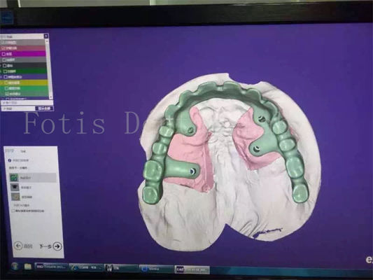 Studio Desain Gigi Restorasi Dental yang Dibuat Dengan Profesional Untuk Kepuasan Anda