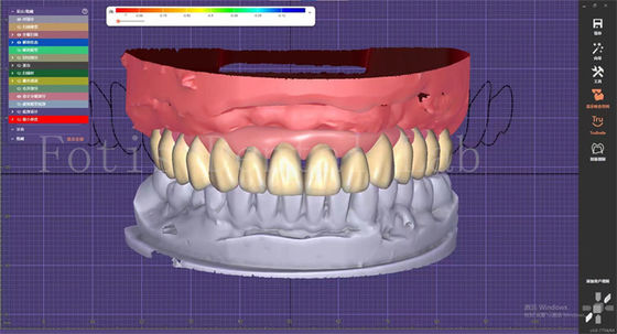 Layanan Desain Gigi Gigi Dengan Perencanaan Prosthesis Dan Desain Implan Oral