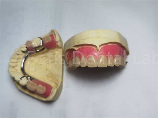 Dental Prothesis / Prothesis Gigi Removable Disesuaikan