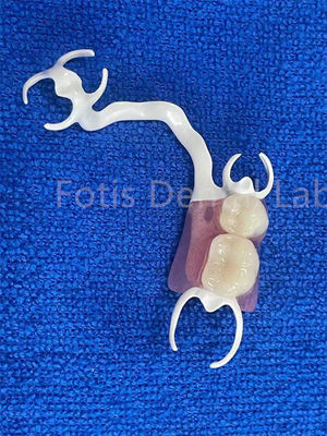 Dental yang dapat disesuaikan dan nyaman untuk mengganti gigi yang stabil