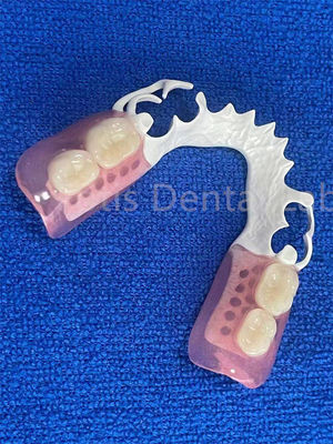 Prosthesis Gigi Fleksibel yang Bisa Disesuaikan
