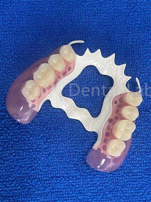 Dental Resistant removable bagian yang stabil mengganti gigi palsu yang hilang