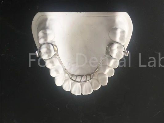 Penyimpanan yang dapat disesuaikan Penyimpanan Palatal Expander Penyimpanan yang mudah dirawat