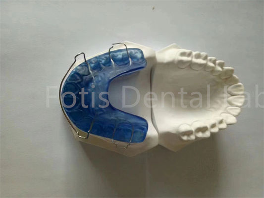 Mudah Pakai Rapid Palatal Expander Retainer Untuk Kebersihan Dan Kenyamanan