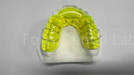 Aman Miechigan Retainer Expander / Orthodontic Spacer Perangkat Nyaman