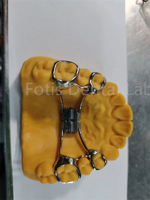 Hygienic Orthodontic Expander Mudah Untuk Membersihkan Gigi Gigi Retainer Desain yang disesuaikan