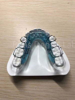 Pengendali Pengendali Palate Expander Aman Solusi Pengendalian Gigi Nyaman