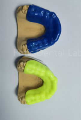 Advanced Orthodontic Retainer Expander Untuk Perawatan yang Tepat dan Nyaman