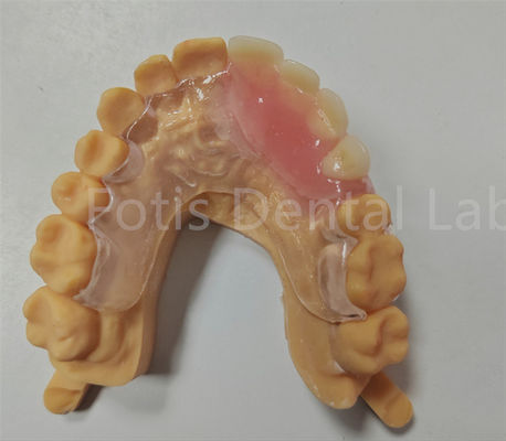 Peralatan Gigi TCS Parsial Flexible Valplast