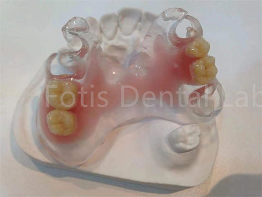Hipoalergenik tahan noda TCS Valplast Prosthetics Gigi Untuk kenyamanan yang tahan lama