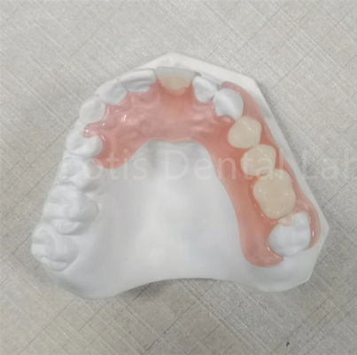 Pink / Transparan TCS Valplast Protesis Gigi Fleksibel Bertahan Bau