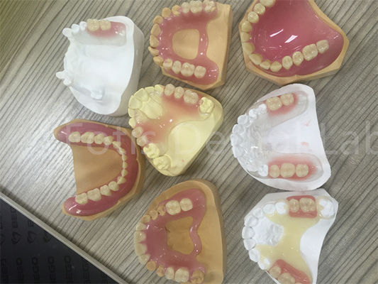 Fleksibel TCS Valplast Removable Parsial Gigi Mudah untuk menyesuaikan