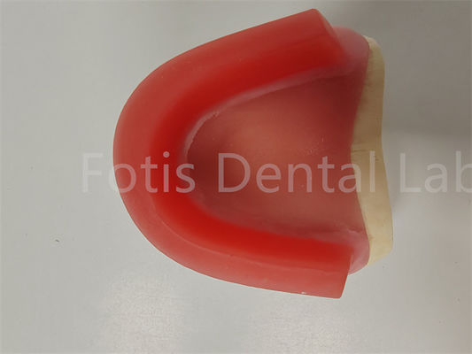 FDA persetujuan gigitan Registrasi lilin Rims Gigi Occlusal Rim