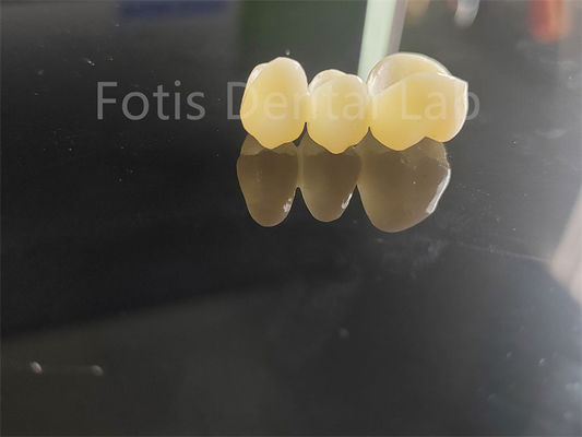 Industri Gigi Zirconia Lapisan Dengan Porselen Solusi Lama