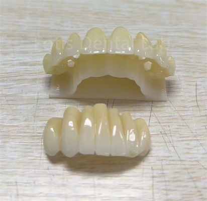 Precision Zirconia Multilayer Product Untuk Meningkatkan Ketahanan Fraktur