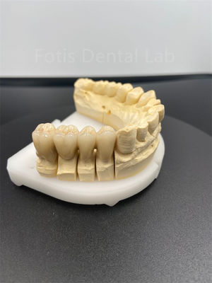 Kinerja Baik Dental Zirconia Multilayer Solusi Keramik Ultimate