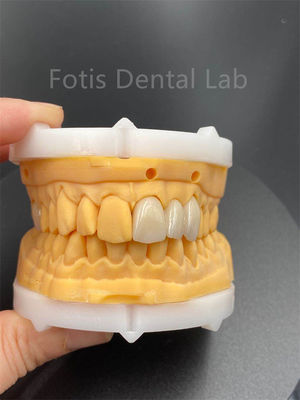 Keramik Gigi Zirconia Berlapis Tinggi Untuk Produk Medis Laboratorium Gigi