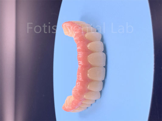 Produk Multilayer Zirconia Kekuatan Tinggi Untuk Kinerja Superior
