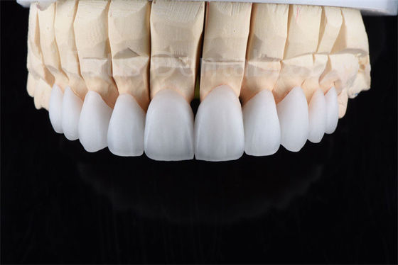 Tahan retak Zirconia Keramik Multilayer Solusi Utama Untuk Efisiensi Industri