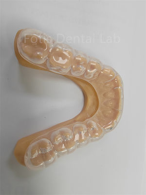 Ergonomis Hard Soft Occlusal Guard Soft Teeth Guard Penggunaan jangka panjang