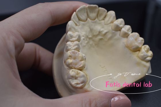 Inlay dan Onlay Gigi Modern yang Bisa Disesuaikan Aplikasi Serbaguna