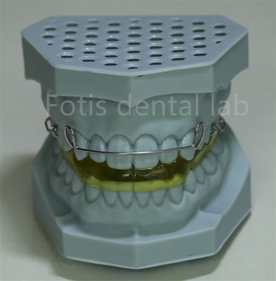 China Dental Lab Lingual Wire Retainer Untuk Ekspansi Gigi