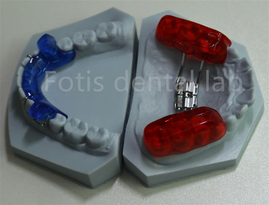 Efektif Retensi Gigi Dental Laboratorium Ortodontik Penjaga Ruang untuk Membesarkan Gigi