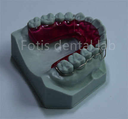 Pengendali Ortodontik Expander Solusi Nyaman Dan Murah