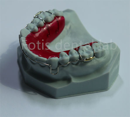China Dental Lab Retainer Expander Untuk Retensi Gigi Dan Ekspansi