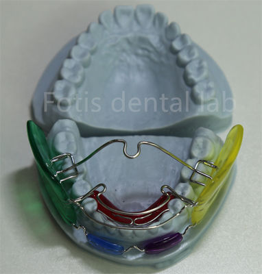 Dental Lab Ortodontik Palatal Expander Serbaguna dan Efektif untuk keselarasan gigi
